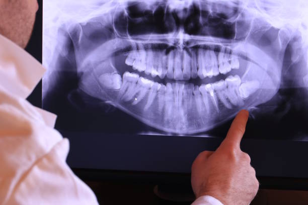 Best Urgent Care for Lost Fillings or Crowns in White Plains, NC
